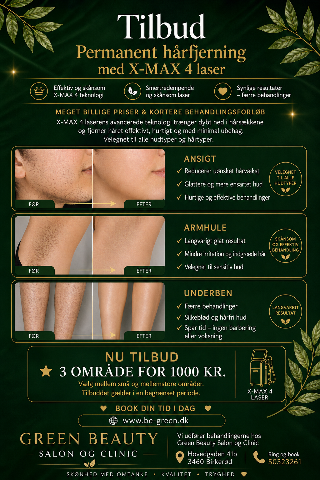 Tilbud på permanent hårfjerning med X-MAX 4 laser – 3 områder for 1.000 kr. hos Green Beauty Salon & Clinic i Birkerød